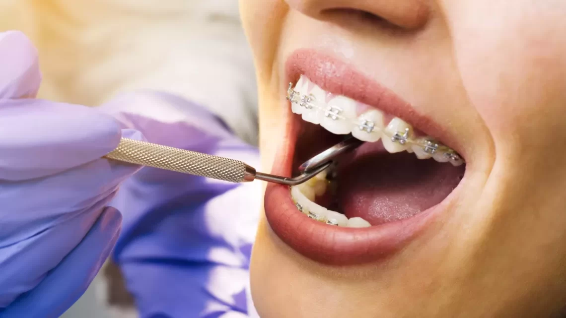 Orthodontiste vs Dentiste Général : Quelle Est la Différence ?